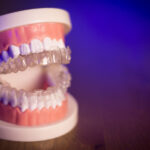 Kivehető fogszabályozó készülék